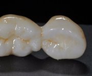 zirconia-prettau-colorato-3